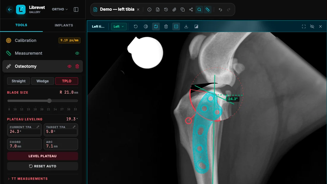 Librevet Ortho 2D planning a TPLO: the tibial plateau angle measured at 24.3 degrees with a target of 5 degrees, a 21 mm osteotomy arc on the radiograph, and a 3.5 mm plate overlaid at true scale.